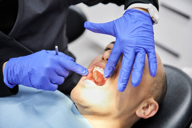 Best Emergency Dental Care for Abscessed Tooth in Cornelius, NC